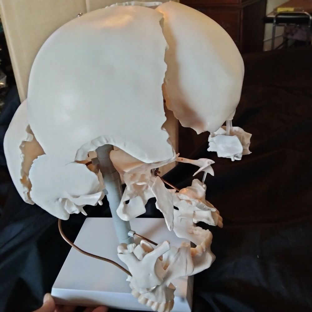 22-Piece Exploded Human Skull Model, Full Size, Bone Color Disassembled Cranial - Picture 8 of 12
